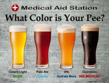 Farbe des Urin Hydration